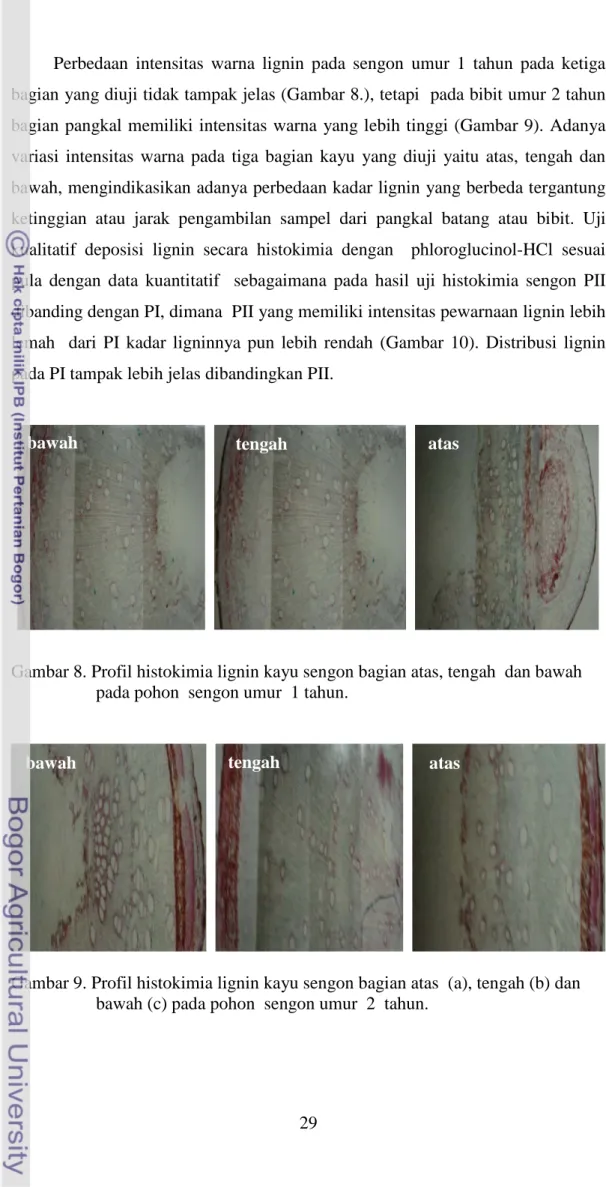 Gambar 8. Profil histokimia lignin kayu sengon bagian atas, tengah  dan bawah  pada pohon  sengon umur  1 tahun