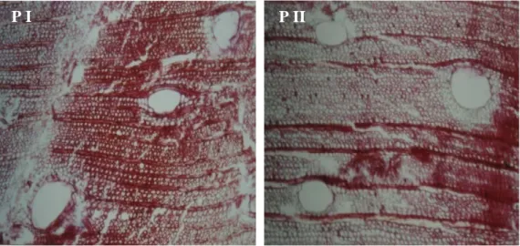Gambar 10. Profil histokimia lignin kayu sengon dewasa yang dikoleksi dari  Cibinong.  