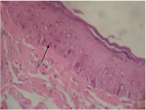 Gambar 7. Epitel nasofaring normal. Tampak proliferasi sel masih dalam batas  normal. Tidak tampak adanya hiperplasia atau displasia