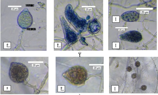 Gambar 2.  Bentuk sporangium  yang ditemukan  yaitu  ovoid,  obpyriform,  globose,  ellipsoid  dan  distorted