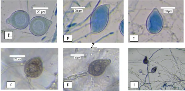 Gambar  2C,D.  Bentuk  sporangium  dan  sporangiofor  Phytophthora  capsici. C.  Isolat  KW-2  (1.ovoid, 2