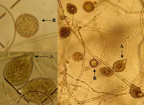 Gambar 3  P. palmivora : Sporangium (A) dan klamidospora (B) (Koleksi foto     pribadi)