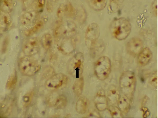 Gambar  5  memperlihatkan  epitel  mukosa  nasofaring  pada  pengecatan  AgNOR.  Bercak  AgNOR  tampak  sebagai  titik  coklat  atau  hitam  dalam  inti  sel  epitel