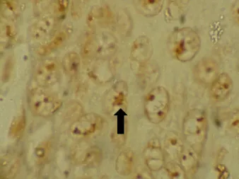 Gambar  1  memperlihatkan  epitel  mukosa  nasofaring  pada  pengecatan  AgNOR.  Bercak  AgNOR  tampak  sebagai  titik  coklat  atau  hitam  dalam  inti  sel  epitel