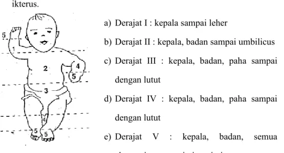 Gambar 2.1. Derajat dan daerah ikterus  Sumber : Saifuddin (2002) 