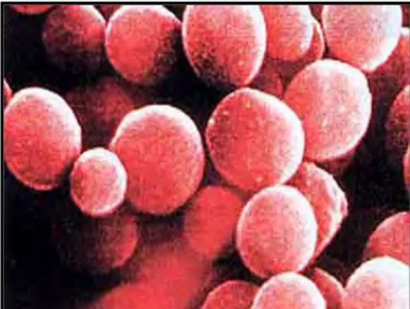 Gambar 4. Staphylococcus aureus (Arbuthnott 1995) 2.5.3    Bacillus cereus 