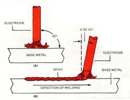 Gambar 3. Teknik Gerakan Elektroda