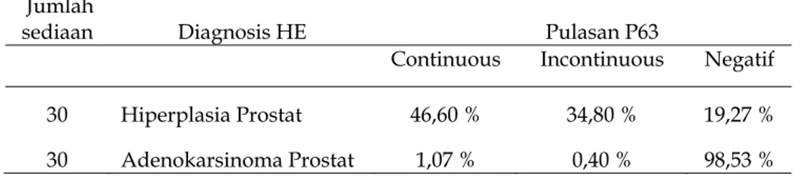 Tabel 1. Persentase imunoekspresi P63 pada asini-asini hiperplasia prostat dan                      adenokarsinoma prostat 