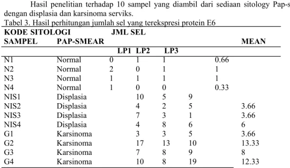 Tabel 3. Hasil perhitungan jumlah sel yang terekspresi protein E6  KODE  SITOLOGI   JML SEL 