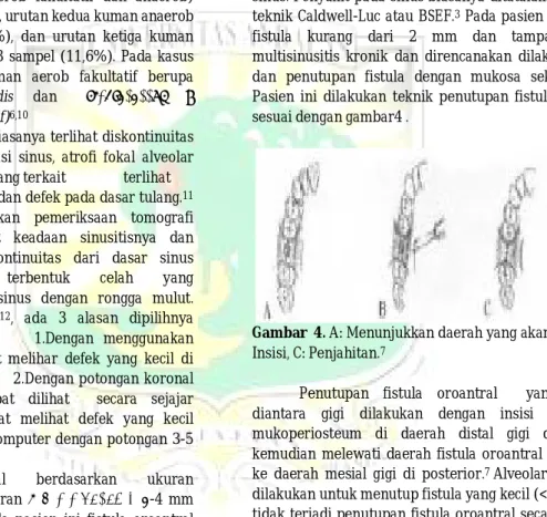 Gambar  4. A: Menunjukkan daerah yang akan diinsisi, B: 