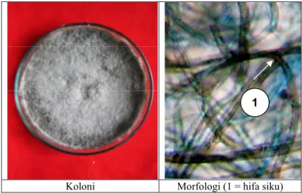 Gambar  2. Koloni dan morfologi jamur  endofit Rhizoctonia   sp. isolat ENDO-08 batang  vanili   Selebung  (Rhizoctonia sp.) 