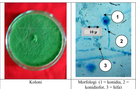 Gambar  4. Koloni dan morfologi jamur  endofit  Penicillium   sp. isolat ENDO-14 akar tanah  vanili  Timbenuh (P