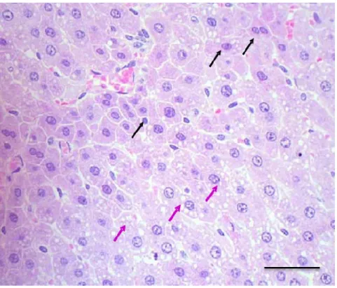 Gambar 4  Hati tikus yang mengalami degenerasi lemak (panah ungu) dan  apoptosis (panah hitam) pasca pemberian fraksi asam amino  non-protein A