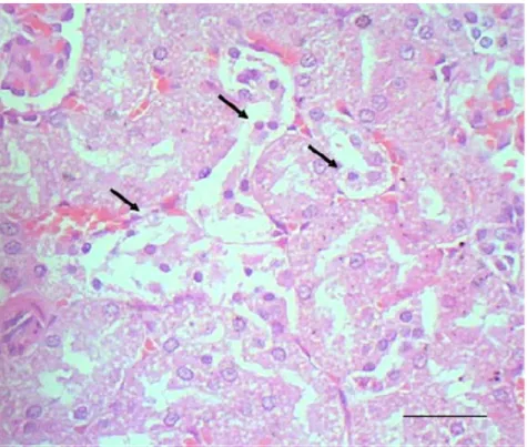 Gambar  5  Tubulus ginjal tikus yang mengalami apoptosis (panah) yang  dikelilingi tubuli yang mengalami degenerasi hidropis pasca  pemberian fraksi asam amino non-protein A