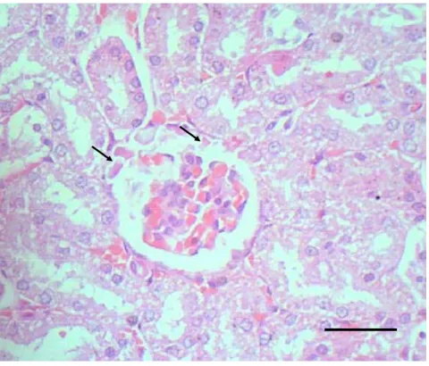 Gambar 7  Edema glomerulus pada ginjal tikus yang dikelilingi oleh tubulus  yang mengalami degenerasi hidropis pasca pemberian fraksi asam  amino non-protein A