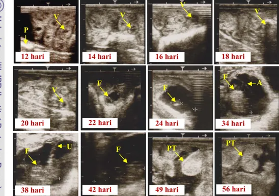 Gambar 5 Ultrasonografi kebuntingan domba garut. Hari ke-12 sampai hari ke-20 hanya  terlihat cairan hypoechogenic dari vesikel embrionik (V)