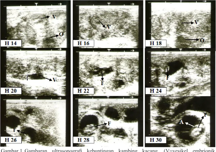 Gambar 1. Gambaran  ultrasonografi  kebuntingan  kambing  kacang.  (V=vesikel  embrionik,  O=ovarium, F=fetus, A=amnion).