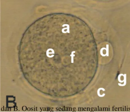 Gambar 2. Oosit. A. Oosit matang yang dikoleksi dengan perbesaran 20X10 dan B. Oosit yang sedang mengalami fertilisasi in  vitro (embrio tahap 1 sel) dengan perbesaran   40X10