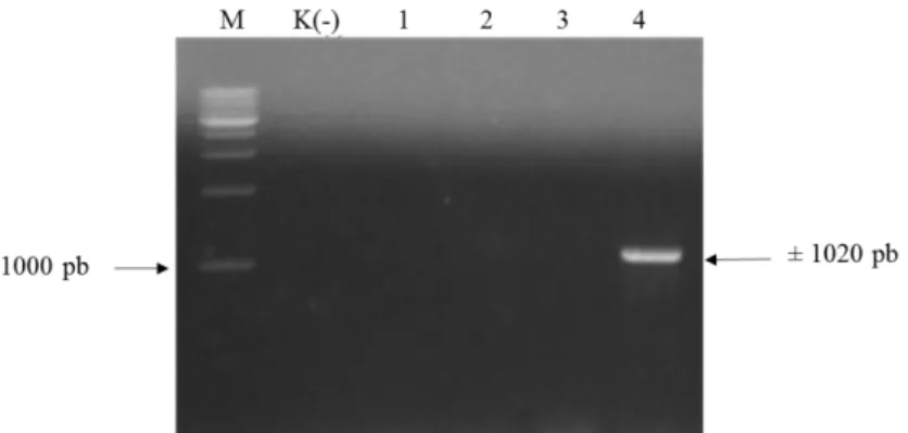 Gambar  8  Hasil  verifikasi  koloni  yang  membawa  plasmid  pC13-35S-Intron- pC13-35S-Intron-Sma