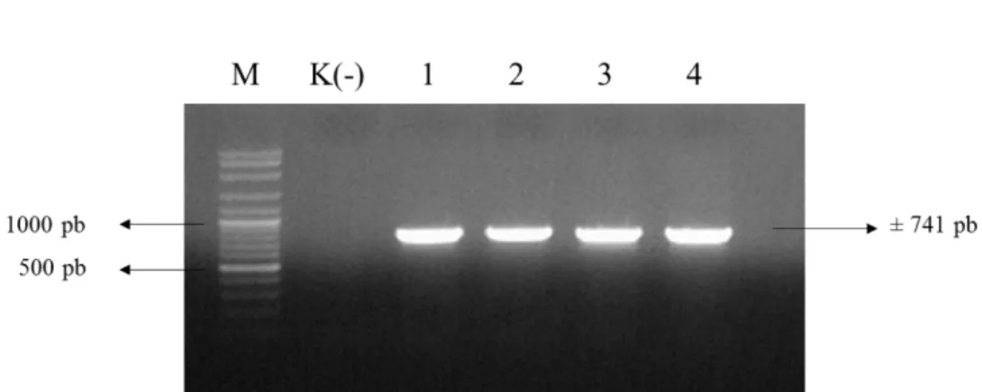 Gambar 14 Hasil verifikasi keberadaan T-DNA pC13-35S-Intron-Sma pada empat  galur kalus transgenik (M= penanda 100 pb) 