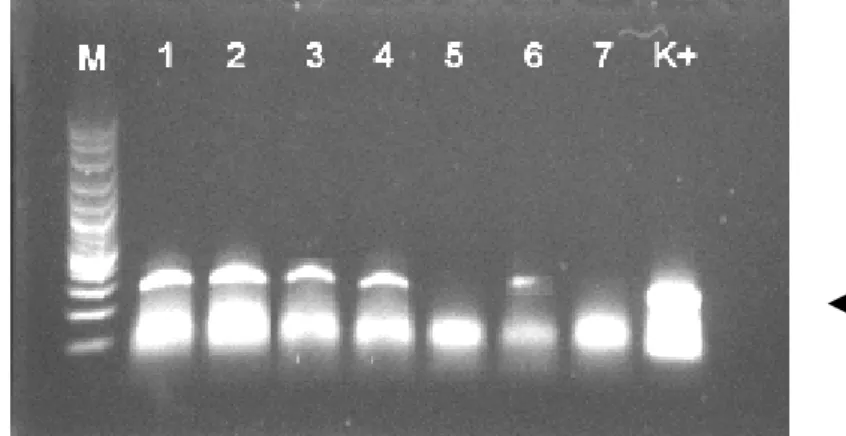 Gambar  9.  Deteksi ekspresi dari transgen pada ikan transgenik generasi  pertama (F 1