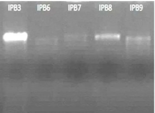 Gambar 2: Hasil Amplifikasi Gen 16S rRNA  dengan Primer 63F dan 1387R  