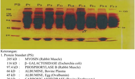 Gambar 1.  Pola Elektroferogram Protein,  BM=37 kD (F1.3), 56 kD (F2.1 dan F2.3) dan 135 (F2.1,  F2.3).