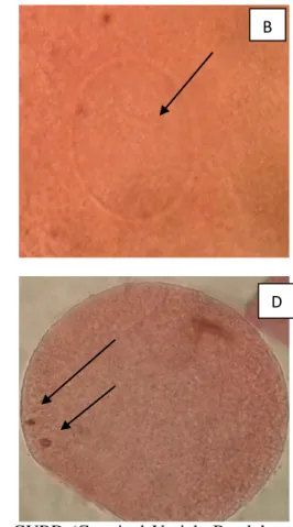 Gambar  3:  a.  GV  (Germinal  Vesicle),  b.  GVBD  (Germinal  Vesicle  Breakdown),  c