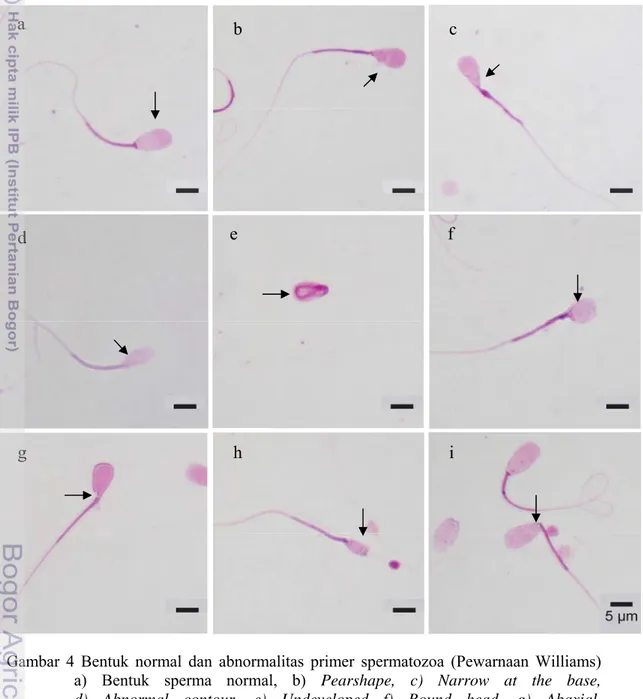 Gambar 4 Bentuk normal dan abnormalitas primer spermatozoa (Pewarnaan Williams)   