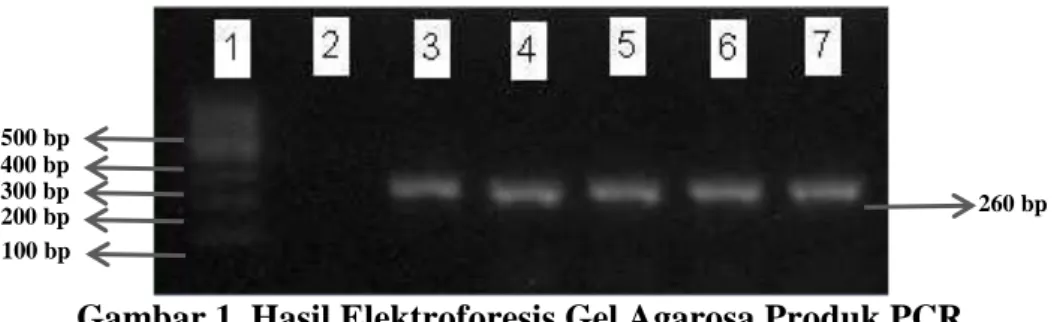 Gambar 1. Hasil Elektroforesis Gel Agarosa Produk PCR  Kolom 1 menunjukkan 100 bp DNA ladder