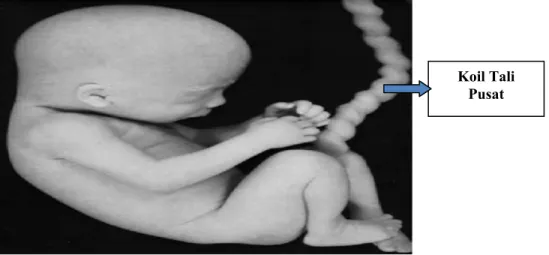 Gambar 6. Janin dengan koil tali pusat. Dikutip dari : Langman’s General                        Embriology 