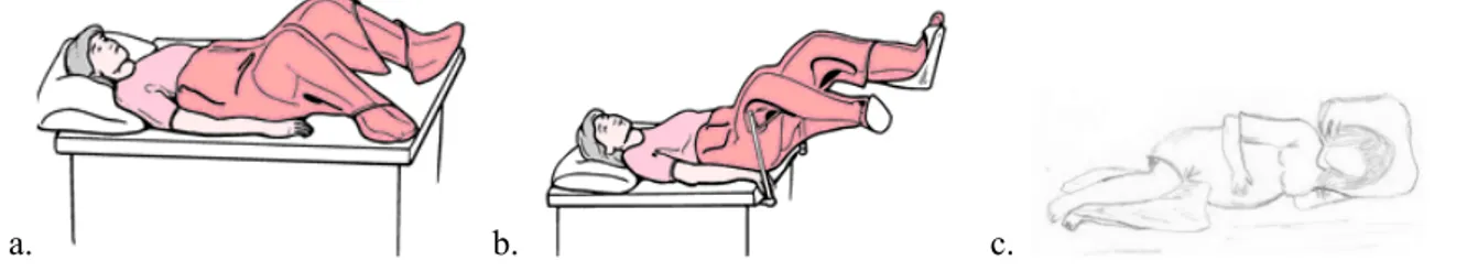 Gambar 2 : Beberapa posisi persalinan: (a) dorsal recumbent, (b) litotomi, dan (c) berbaring ke  samping kiri