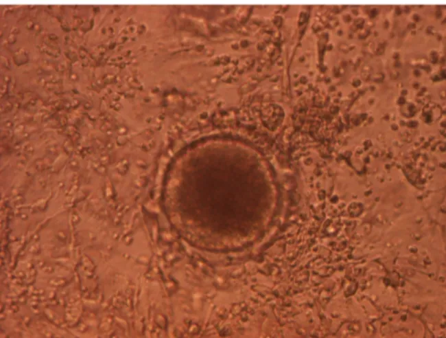 Gambar 2. Foto mikroskopis oosit domba setelah diinkubasi selama 24 Jam (1 Hari). Corona radiata berkembang secara sempurna