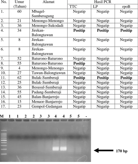 Gambar 1.  Hasil PCR Berbasis Regio Pengulangan TTC Pada M. Leprae (170  bp) 