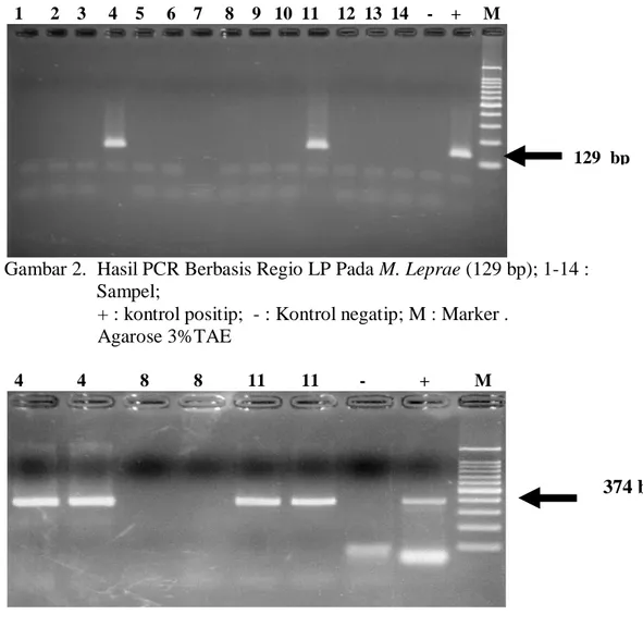 Gambar 2.  Hasil PCR Berbasis Regio LP Pada M. Leprae (129 bp); 1-14 :  Sampel; 