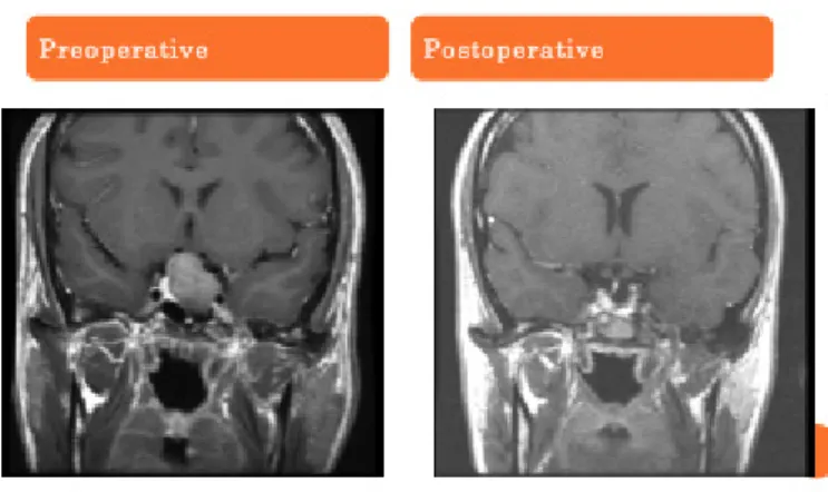 Gambar 2. MRI Scans 1  Pengobatan 