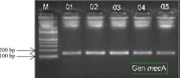Gambar 3. Amplikon gen mecA hasil PCR dengan berat molekul sekitar 147 bp  (sumber: Yuwono, 2009)