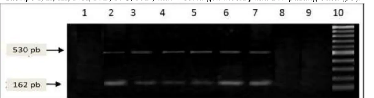 Gambar 3. Deteksi gen mecA yang telah diamplifikasi dengan menggunakan Gel Electrophoresis 19