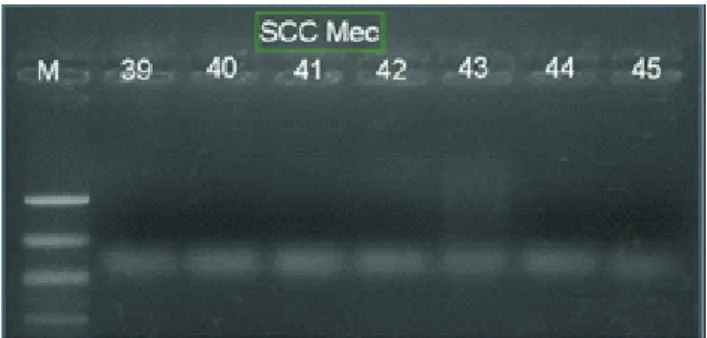 Tabel 2 Hasil PCR Multipleks Tipe SCCmec Isolat MRSA Tipe SCCmec  Jumlah Frekuensi  Persentase  I          0           0  II          0           0  III        40         89  IV          5         11 