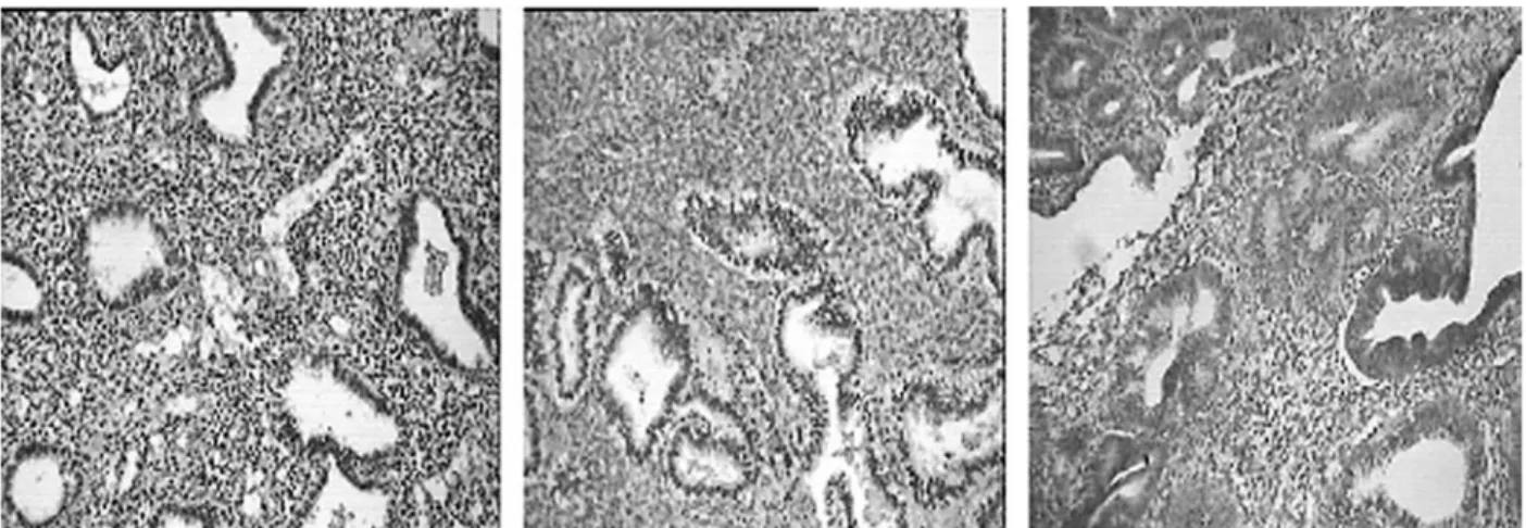 Gambar 1. Kerapatan RE pada Sel Epitel Kelenjar dan Sel Stroma Endometrium. Kerapatan RE tinggi (&gt; 80%) menunjukkan warna coklat tua, kerapatan RE sedang (50 - 80%) menunjukkan warna coklat, sedangkan kerapatan RE rendah (20 - 50%) menunjukkan warna cok