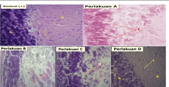 Gambar 1 Histopatologi otak kerapu tikus (Cromileptes altivelis) yang terinfeksi VNN dengan pewarnaan H-E dan perbesaran 400x
