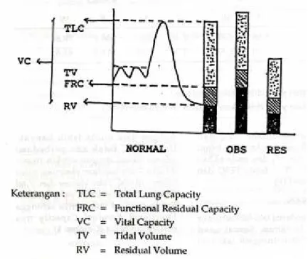 Gambar  1.  Volume  normal  paru  dan  perubahannya bila  ada  kelainan  obstruksi  (OBS)  dan  restriksi (RES)