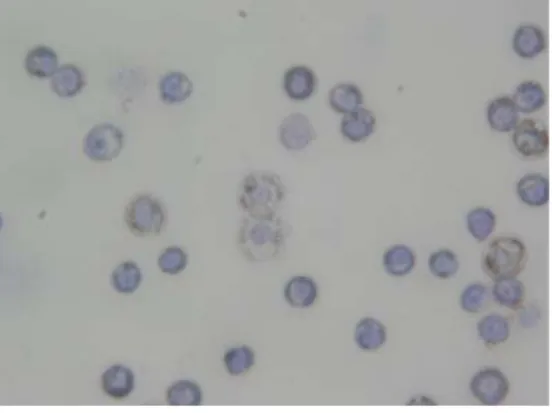 Figure 3. Antigen phagocytosis by phago- phago-cyte cell post challenge test (100x magnificent)
