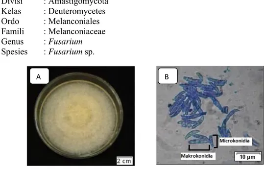Gambar 2.9 Koloni Fusarium (A), Morfologi Fusarium sp. (B)  Sumber : Fausi dkk., (2009)  