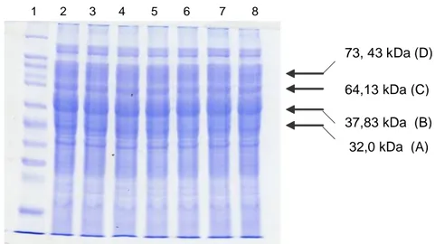 Gambar 1.  Protein outer membran V. alginolyticus 8. Lajur 1 marker. Lajur 2-8 protein outer  membran V