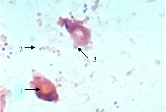 Gambar  4  (b),  hasil  perlakuan  dosis  100  µg  protein  fimbria  F16,  tampak  sel-sel  bakteri  yang  melekat  pada  sel  epitel  enterosit  semakin  berkurang  jika  dibandingkan  dengan  pemberian  dosis  0  µg  dan  25  µg  dan  analisis  statistik