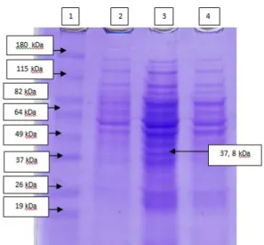 Gambar 2. Hasil SDS-PAGE protein potongan ke-1  Keterangan: 