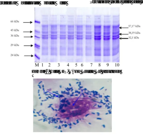 Gambar 3.   Gambaran  Adesi  bakteri  Pseudomonas  aeruginosa  pada  sel  endotel  dengan  pembesaran 1000x dengan Perlakuan Kontrol, Sediaan diwarnai Giemsa 
