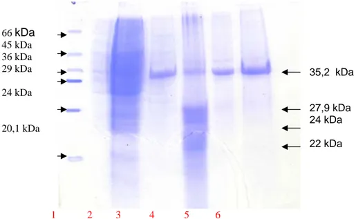 Gambar 1.  Hasil SDS-PAGE whole cell dan potongan pili  P. mirabilis P355. 