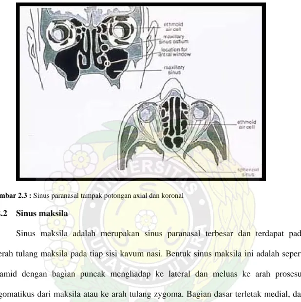 Gambar 2.3 : Sinus paranasal tampak potongan axial dan koronal 
